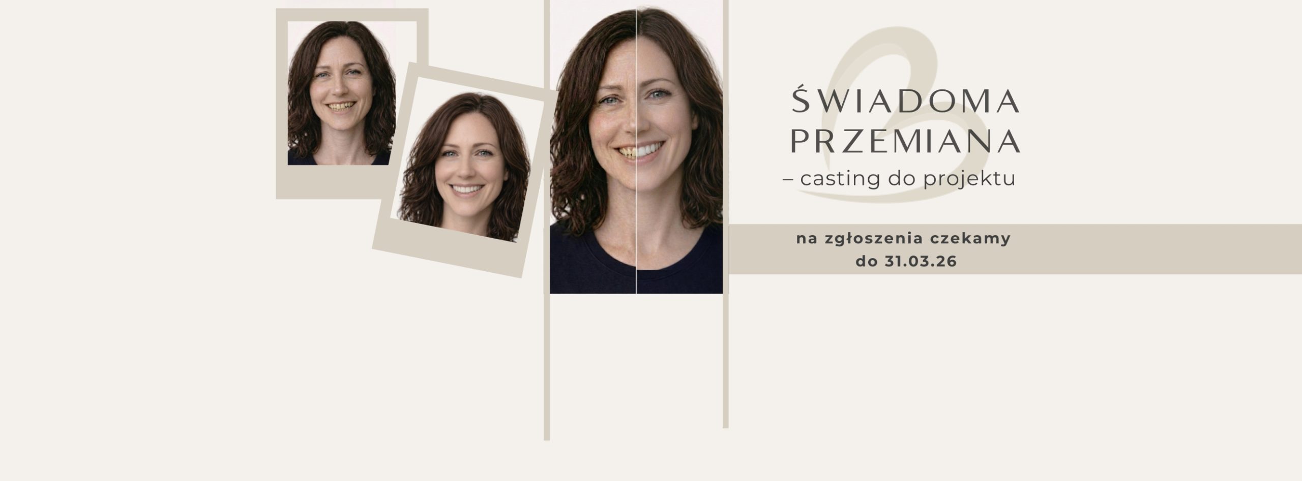 Świadoma przemiana – casting do&nbsp;projektu | Bella Clinica